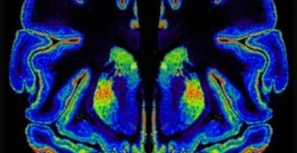 The Epigenetics Of Marijuana Use