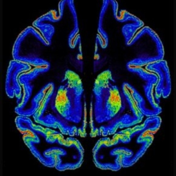 The Epigenetics Of Marijuana Use