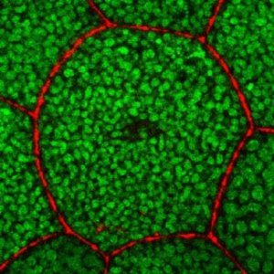 caspases and apoptosis
