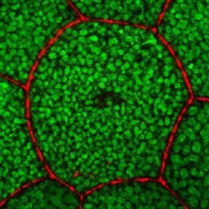 caspases and apoptosis