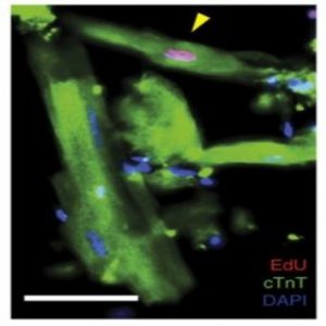 heart muscle repair itself