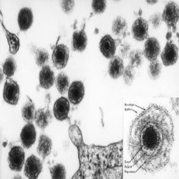Human Herpesvirus 6 the Ancient Herpes [Research] BioTechniques