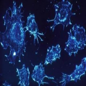 sleeping cancer cells