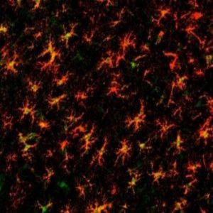 Astrocytes