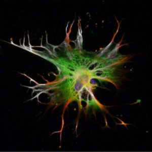 Brain cells (Astrocytes) grown from embryonic stem cells