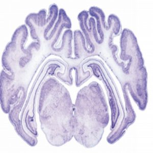 Section of a pig brain.