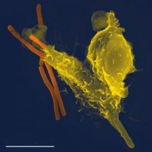 Broadly neutralizing antibodies: a combination to be reckoned with for HIV.