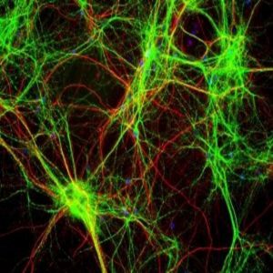 Human brain dendrites deliver signals at a greater variation in strength than those of rats