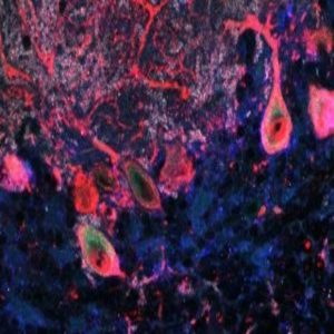 Cerebellar purkinje cells with increased levels of ASTN2
