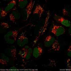 Live cell imaging example