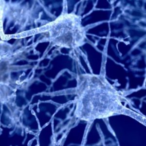 What are the causes of Parkinson disease?
