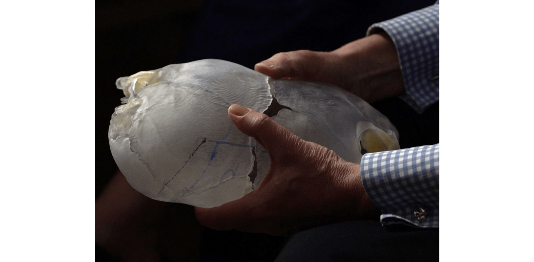 3D printed skull