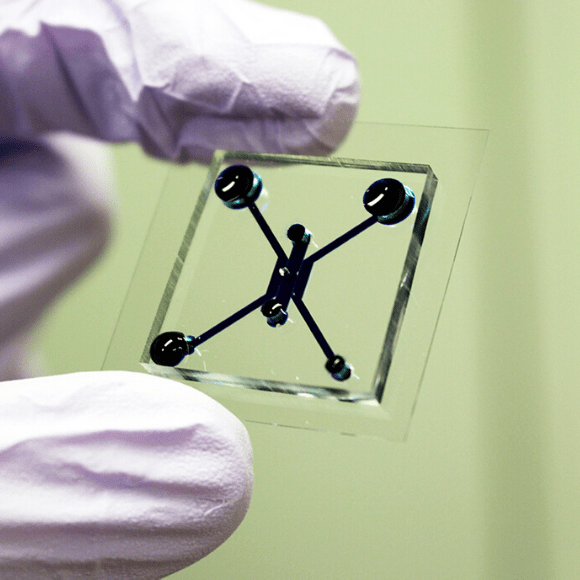 tumor-on-a-chip