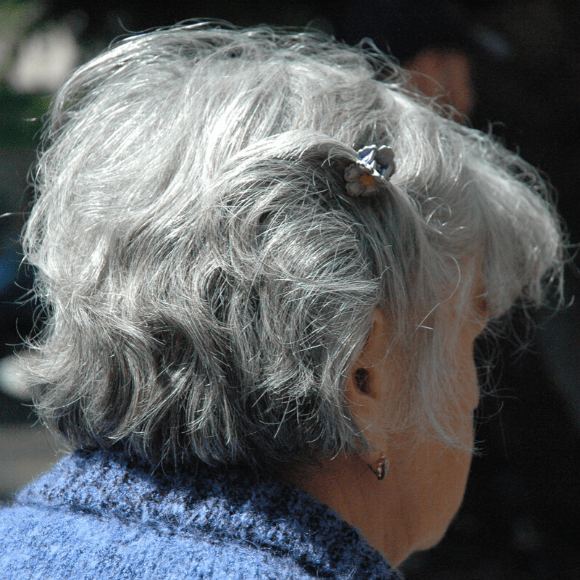 Stress as a Cause of Premature Graying of Hair - BioTechniques Stress as a Cause of Premature Graying of Hair - BioTechniques
