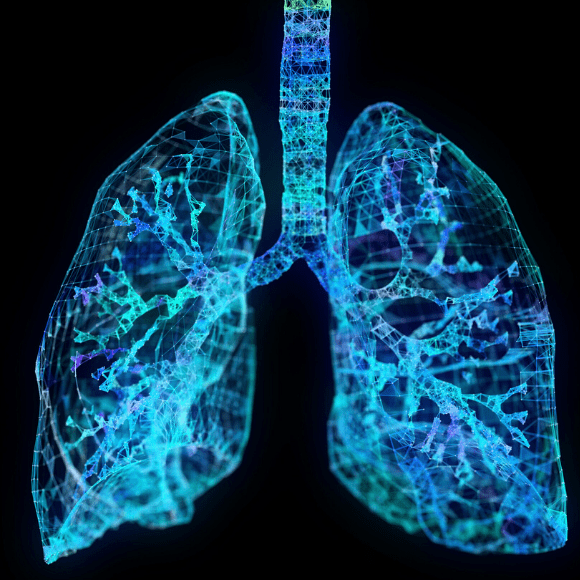 lung model