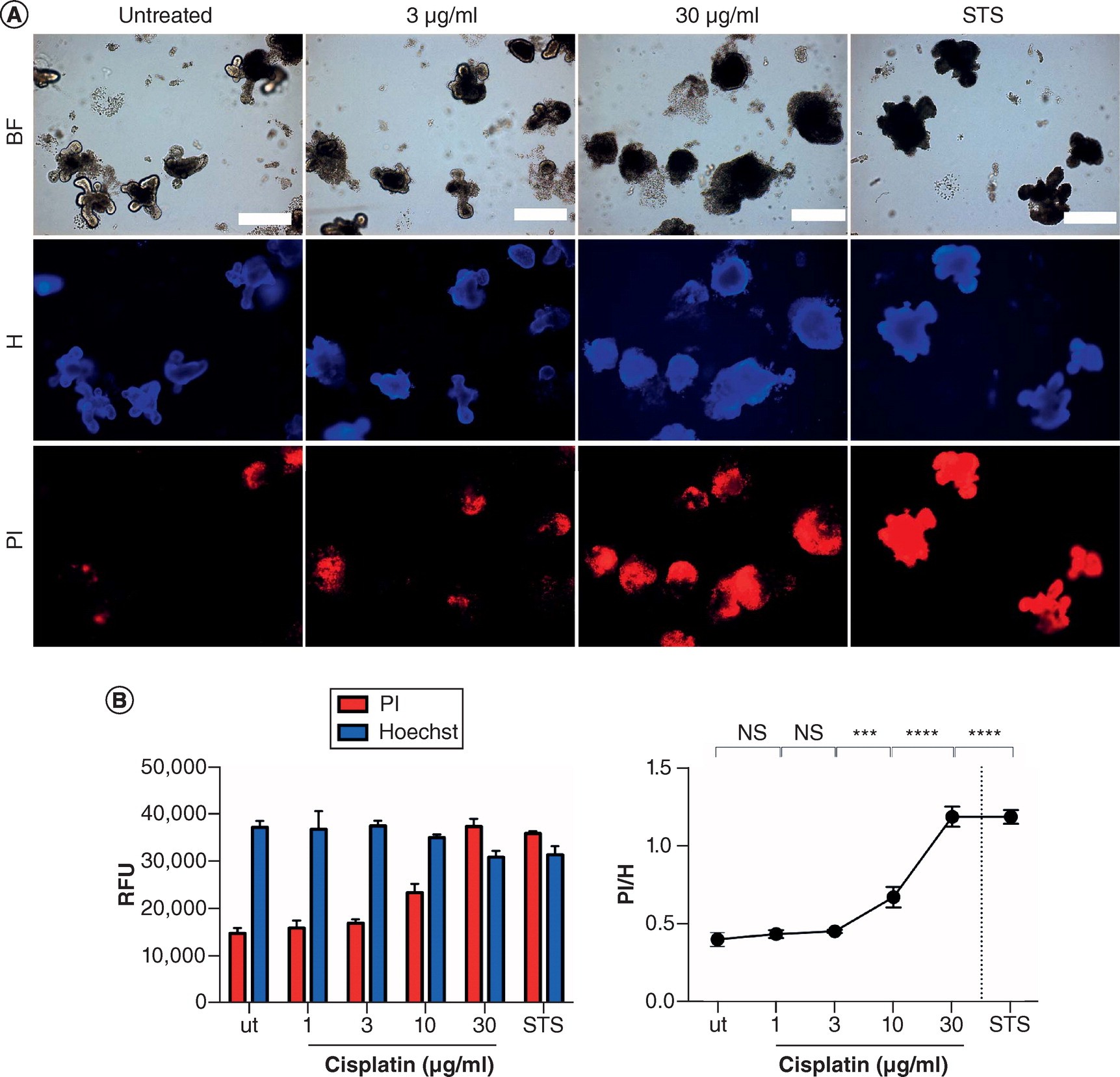 Organoid Paper 1