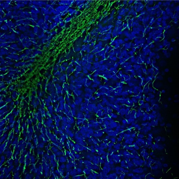 NextGeneration Microscopy Image Analysis with DeepLearning Technology