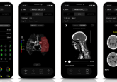 neuroimaging AI