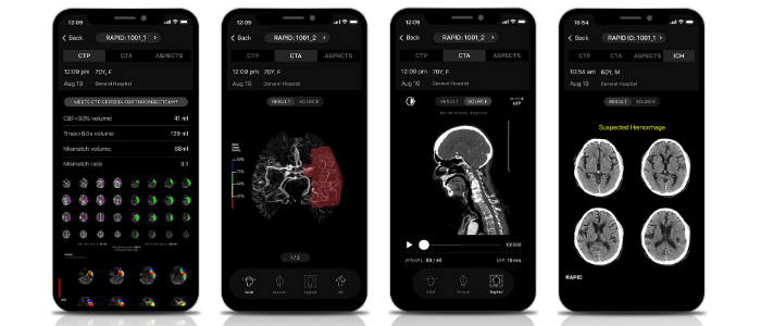 neuroimaging AI