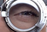 gel electrophoresis eye