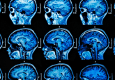 developing brain MRI exercise