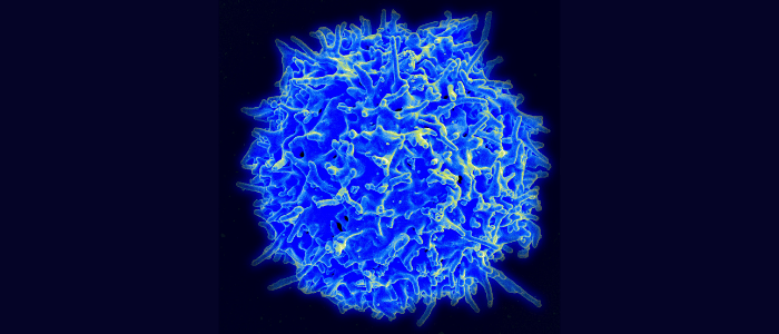 Universal T cell