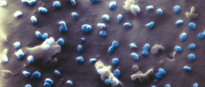 Helium ion microscopy SARS-CoV-2