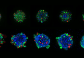 3D cancer cell model images