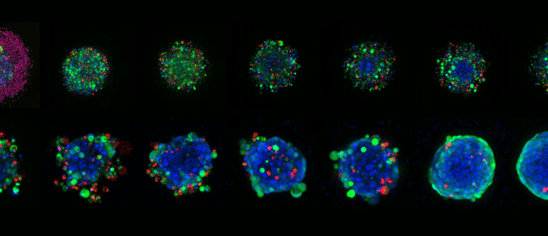3D cancer cell model images