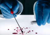 Accelerated aging in forensic studies blood samples