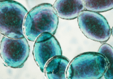 gene regulation yeast cells