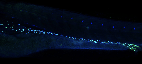 Enteric Nervous System Development in microscope images of zebrafish