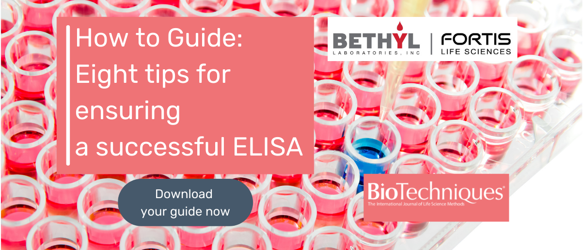 How to Guide Eight tips for ensuring a successful ELISA BioTechniques