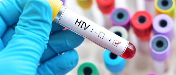 HIV vial