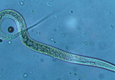 Nematode under microscope