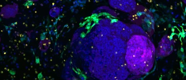 Imaging pancreatic organoids