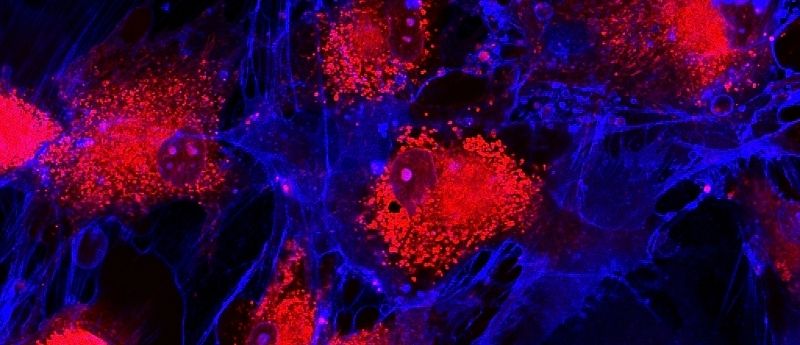 mesenchymal stem cells red blue