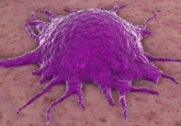 Purple tumour