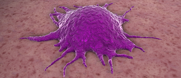 Purple tumour