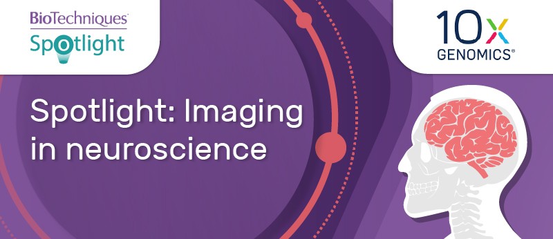 Imaging in Neuroscience - BioTechniques