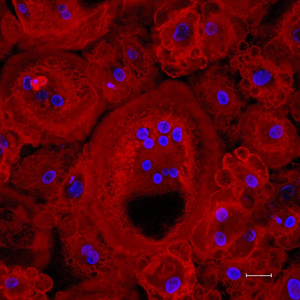 Meet The Researcher Behind Monstrous Osteoclasts BioTechniques meet-the-researcher-behind-monstrous-osteoclasts-biotechniques