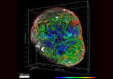 vascular organoid