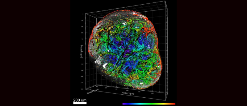 vascular organoid