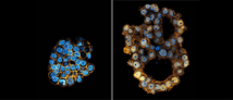 organoids