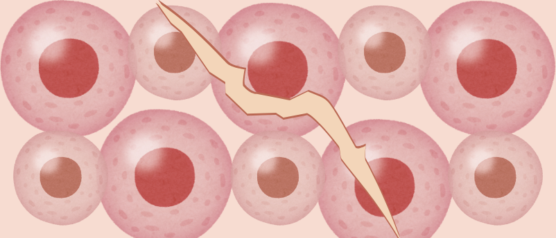 Healing wounded skin without scarring? Preclinical research shows promise