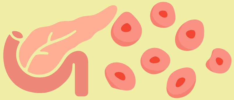 Implantable Islet Cells Could Control Type 1 Diabetes